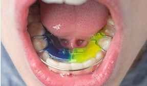 Ortopedia Dentofacial